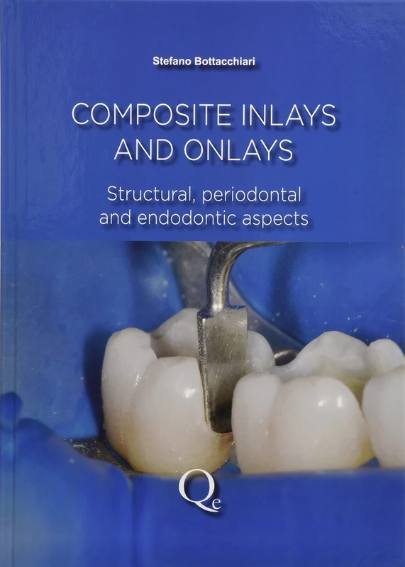 Composite Inlays and Onlays: Structural, Periodontal, and Endodontic Aspects
