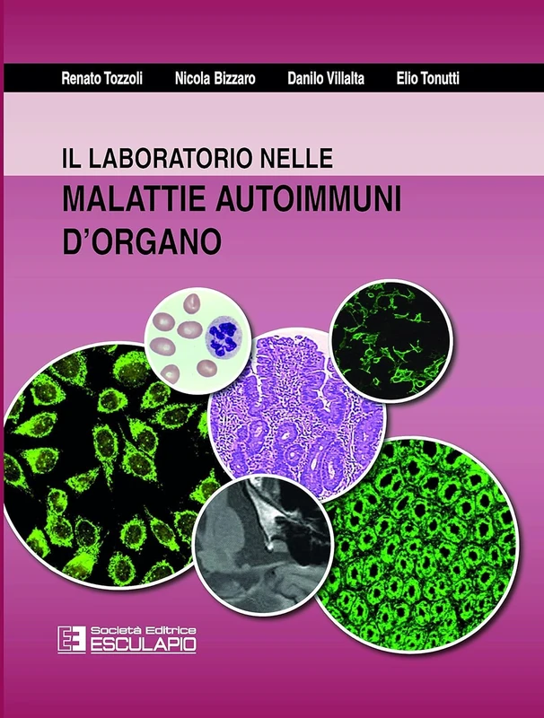 Il laboratorio nella malattie autoimmuni d'organo