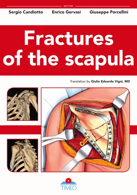 Fractures of the Scapula