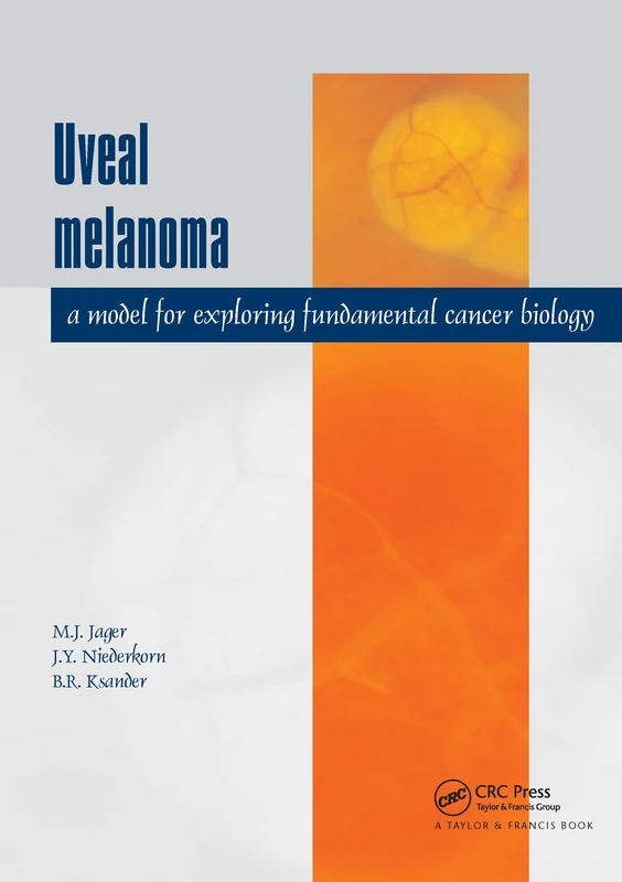 CRC Press - Uveal Melanoma: A Model for Cancer Biology