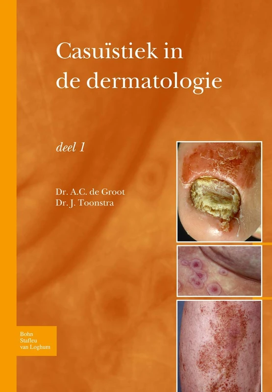 Casuïstiek in de dermatologie - deel I - Image 1