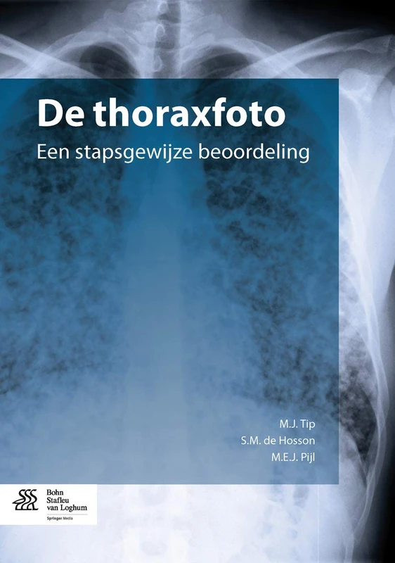 De thoraxfoto: een stapsgewijze beoordeling