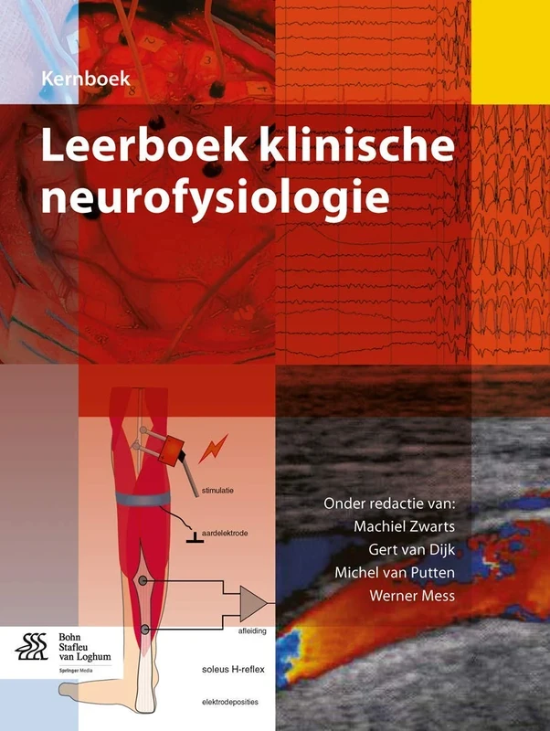 Leerboek klinische neurofysiologie (Kernboek)