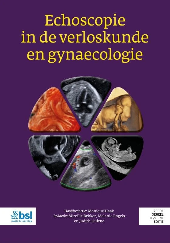Echoscopie in de verloskunde en gynaecologie - Image 1