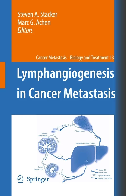 Lymphangiogenesis in Cancer Metastasis: 13 (Cancer Metastasis - Biology and Treatment, 13)