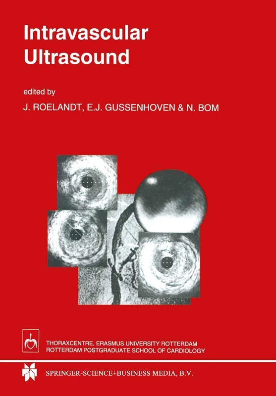 Intravascular Ultrasound: 143 (Developments in Cardiovascular Medicine)