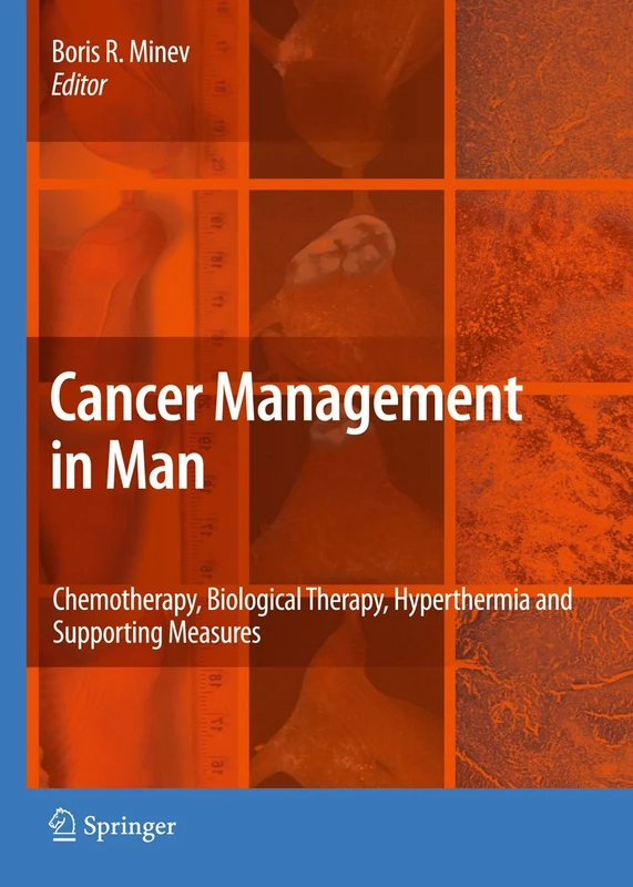 Cancer Management in Man: Chemotherapy, Biological Therapy, Hyperthermia and Supporting Measures: 13 (Cancer Growth and Progression, 13)