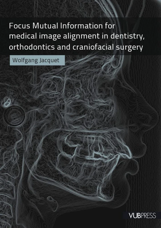 Focus Mutual Information for Medical Image Alignment in Dentistry, Orthodontics and Craniofacial Surgery - Image 1