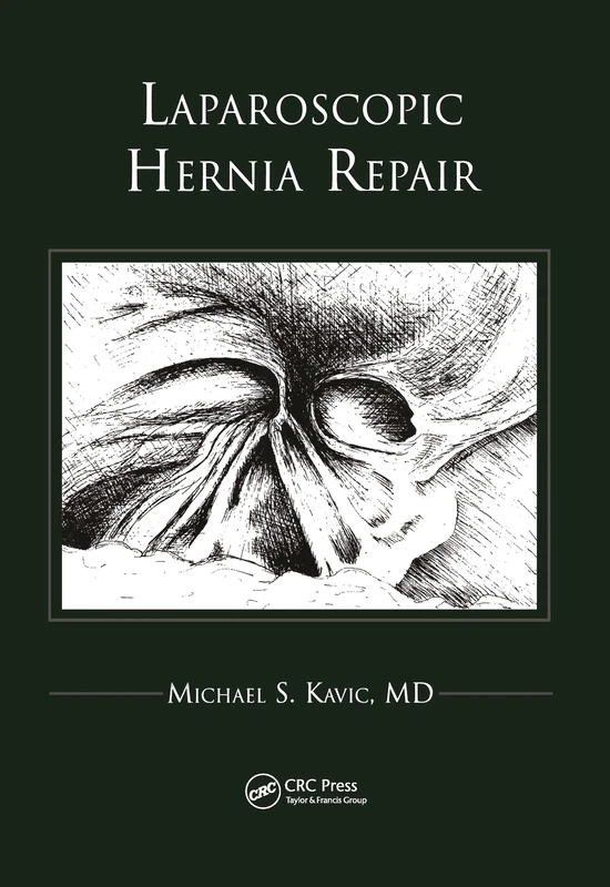 Routledge Laparoscopic Hernia Repair - Medical Textbook