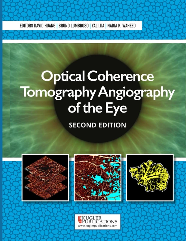 Optical Coherence Tomography Angiography of the Eye - Image 1