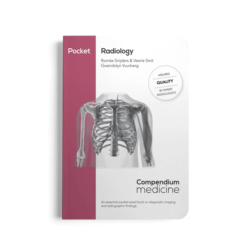 Pocket Radiology: An essential pocket-sized book on diagnostic imaging and radiographic findings.