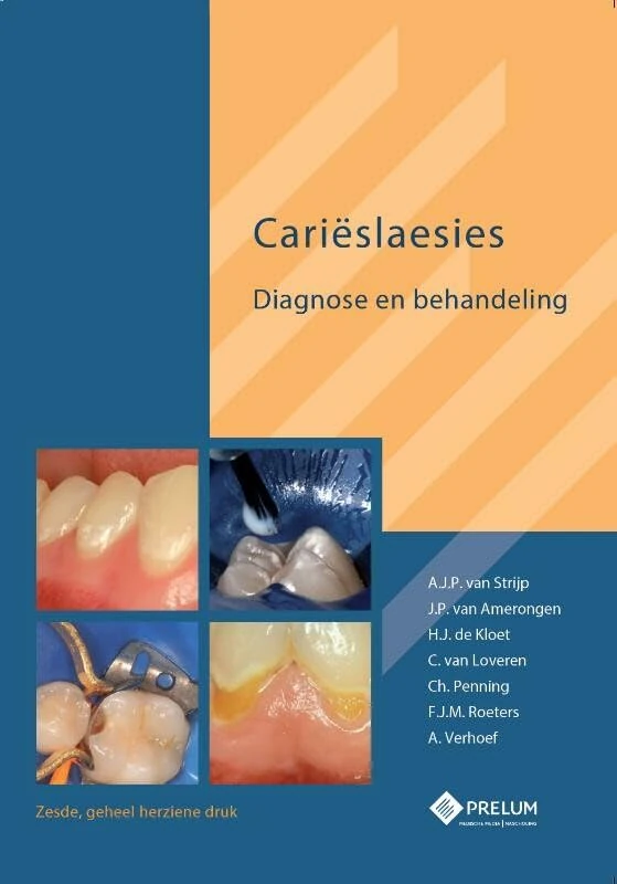 Carieslaesies: diagnose en behandeling - Image 1
