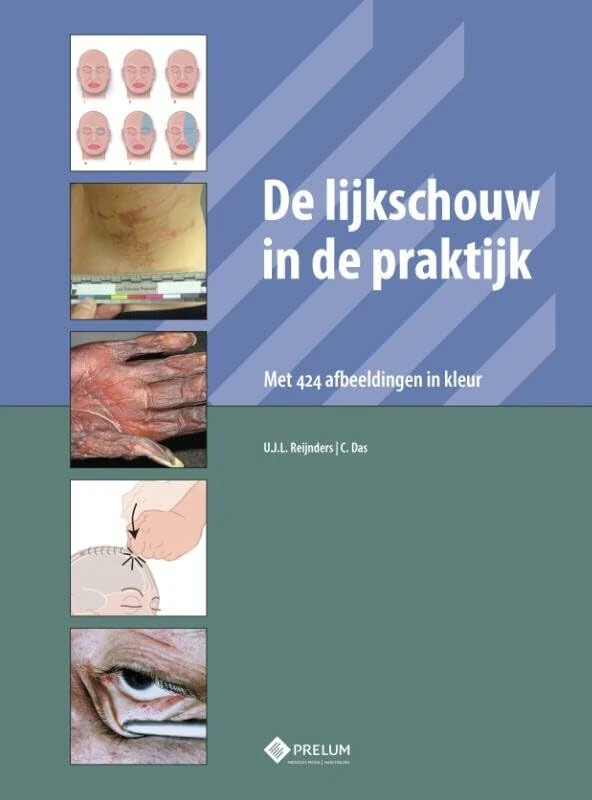 De lijkschouw in de praktijk: met 424 afbeeldingen in kleur - Image 1