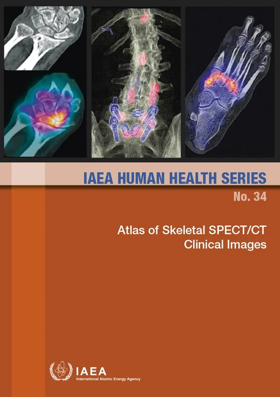 Atlas of Skeletal SPECT/CT Clinical Images (IAEA Human Health Series)