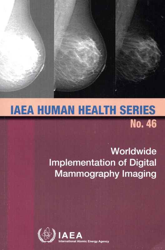 Worldwide Implementation of Digital Mammography Imaging (IAEA Human Health Series)