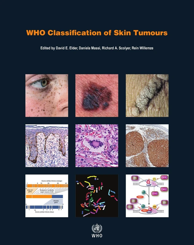 WHO Classification of Skin Tumours: WHO Classification of Tumours, Volume 11 (World Health Organization classification of tumours)