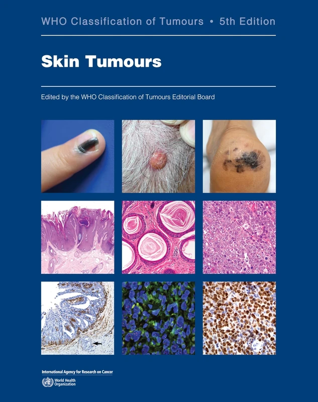 WHO Classification of Skin Tumours 5th edition: Who Classification of Tumours