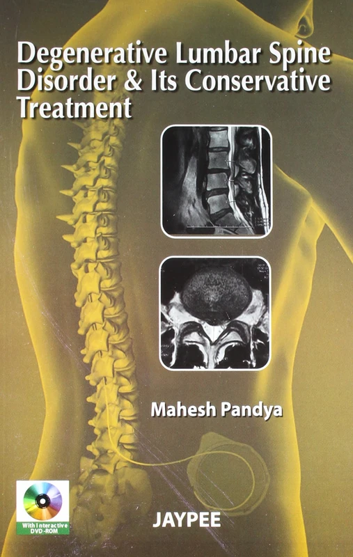 Degenerative Lumbar Spine Disorder & Its Conservative Treatment