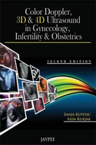 Color Doppler 3d & 4d Ultrasounds in Gynecology Infertility and Obstetrics
