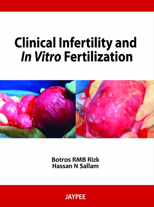Clinical Infertilty In Vitro Fertilizatn