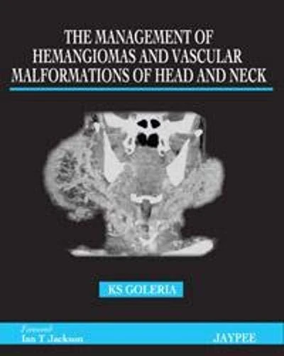 Haemangiomas and Vascular Malformations of Head, Neck and Face