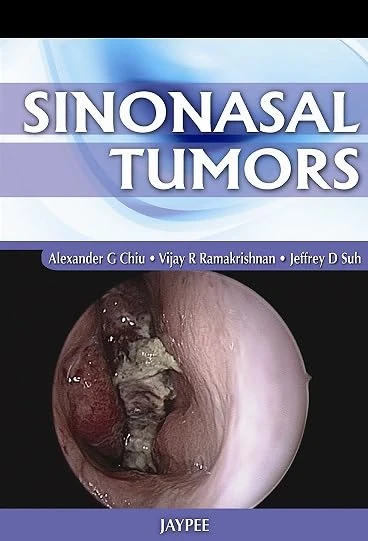 Sinonasal Tumors - Image 1