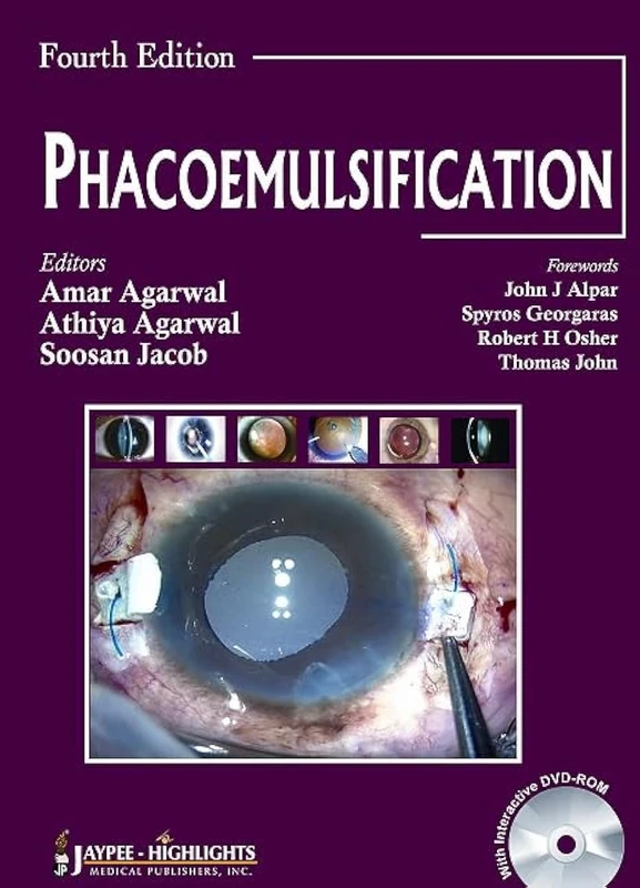 Phacoemulsification 4/E by Jaypee Brothers Medical Publishers - Image 1