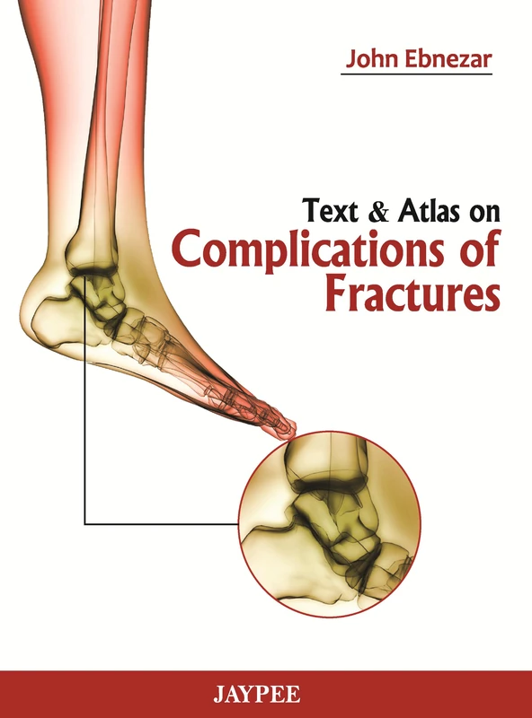 Text and Atlas of Complications of Fractures
