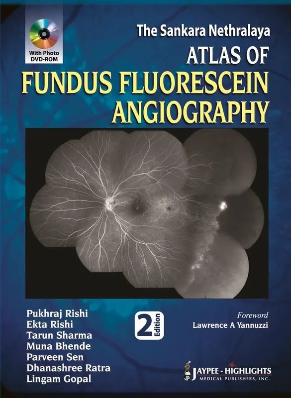 The Sankara Nethralaya Atlas of Fundus Fluorescein Angiography