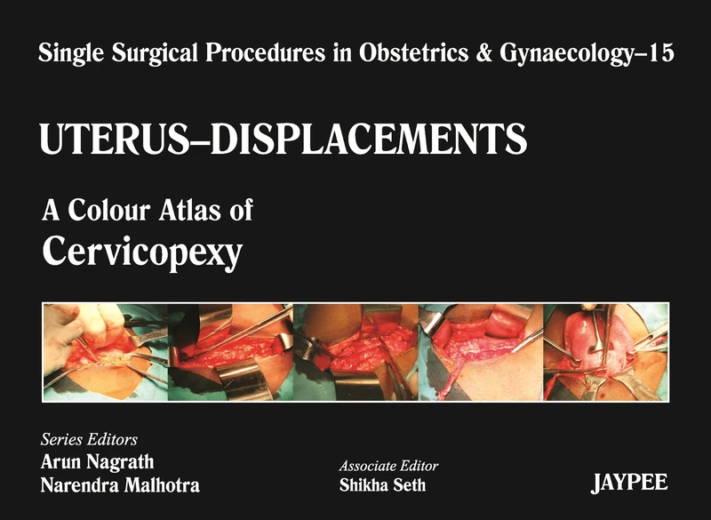SSPOBGYB- Uterus Displacements 15: A Colour Atlas of Cervicopexy (Purandare’s) (Single Surgical Procedures in Obstetrics and Gynaecology)