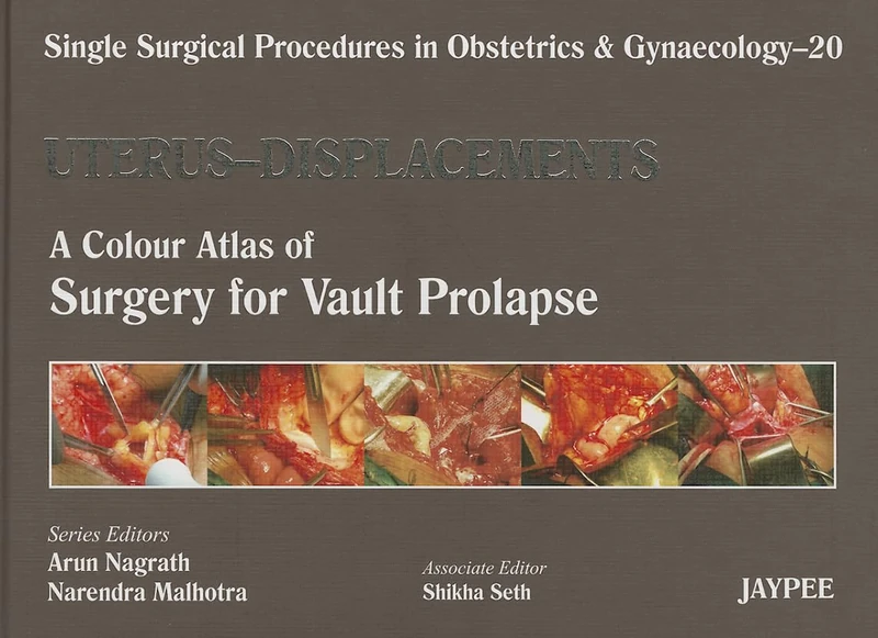 Single Surgical Procedures in Obstetrics and Gynaecology: Uterus - Displacements Volume 20: A Colour Atlas of Surgery for Vault Prolapse (Single Surgical Procedures in Obstetrics & Gynaecology)