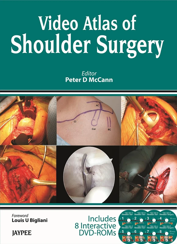 Jaypee's Video Atlas of Shoulder Surgery (DVDs)