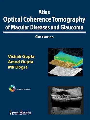 Atlas Optical Coherence Tomography of Macular Diseases and Glaucoma