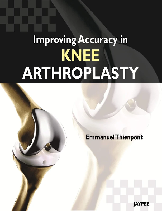 Improving Accuracy in Knee Arthroplasty