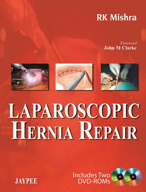 Laparoscopic Hernia Repair
