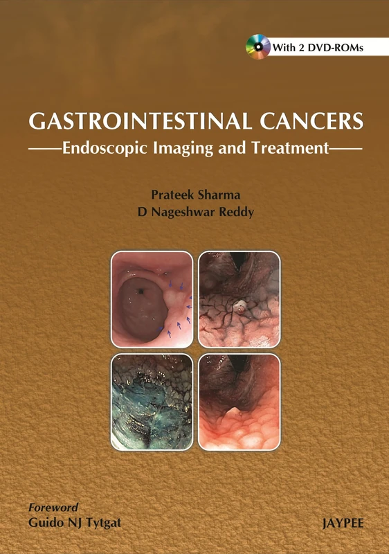 Gastrointestinal Cancers Endoscopic Imaging and Treatment - Image 1