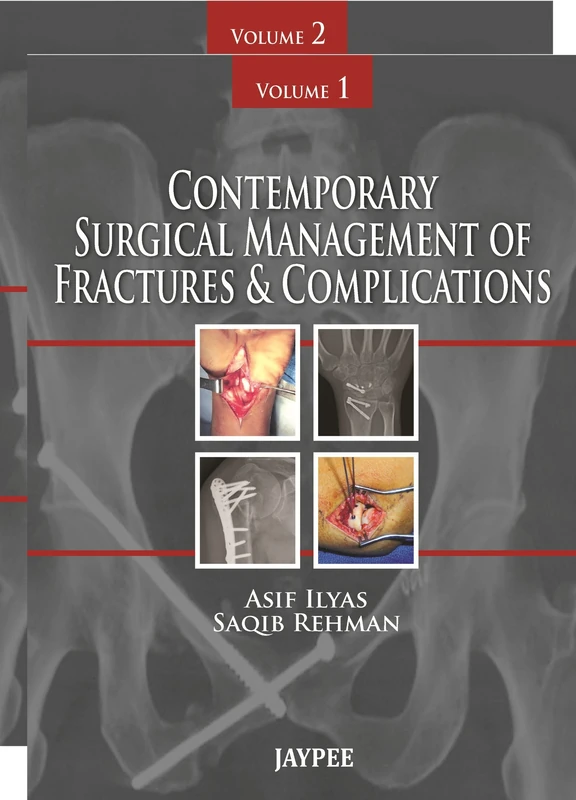 Contemporary Surgical Management of Fractures and Complications