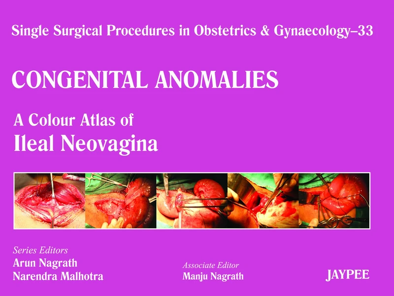 Single Surgical Procedures in Obstetrics and Gynaecology: Vaginoplasty - A Colour Atlas of Ileal Neovagina Volume 33