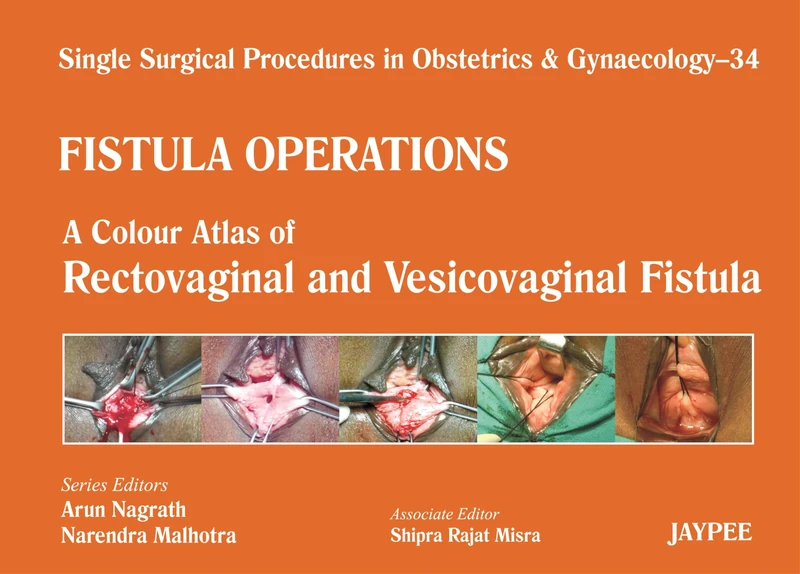 Single Surgical Procedures in Obstetrics and Gynaecology: Fistula Operations - A Colour Atlas of Rectovaginal and Vesicovaginal Fistula Volume 34