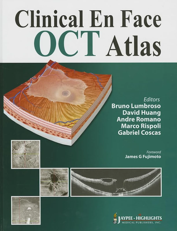 Jaypee Clinical En Face OCT Atlas - Medical Imaging Guide
