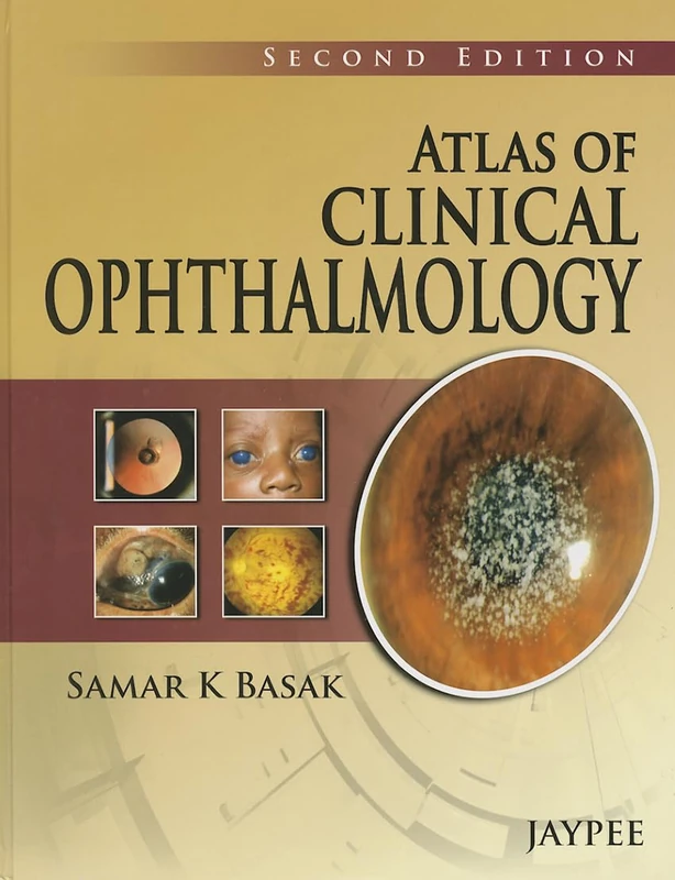 Atlas of Clinical Ophthalmology - Jaypee Brothers Medical