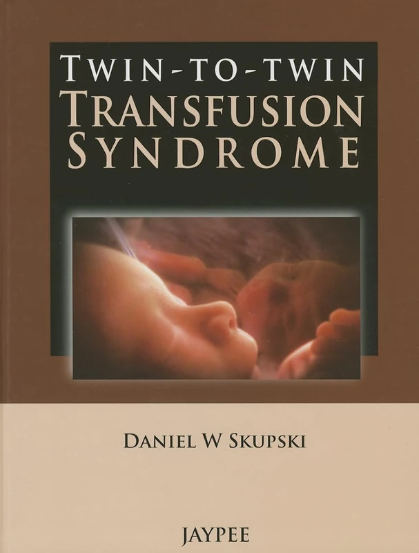 Twin-to-Twin Transfusion Syndrome - Image 1