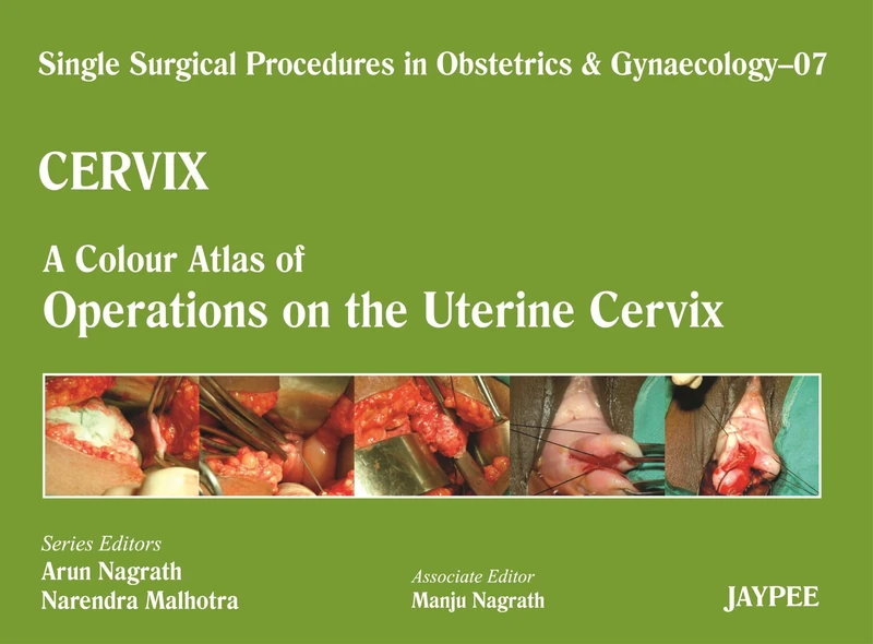 Single Surgical Procedures in Obstetrics and Gynaecology: CERVIX - A Colour Atlas of Operations on the Uterine Cervix Volume 7