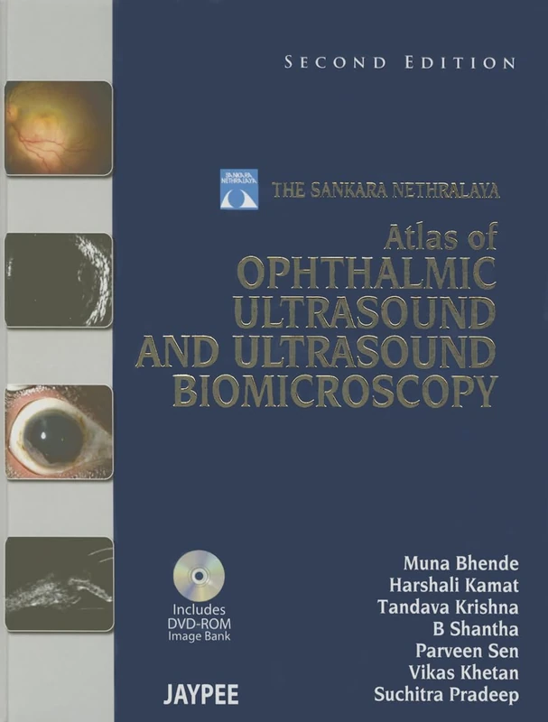 Atlas of Ophthalmic Ultrasound and Ultrasound Biomicroscopy