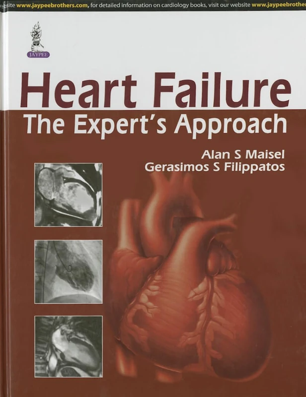 Heart Failure: The Expert's Approach