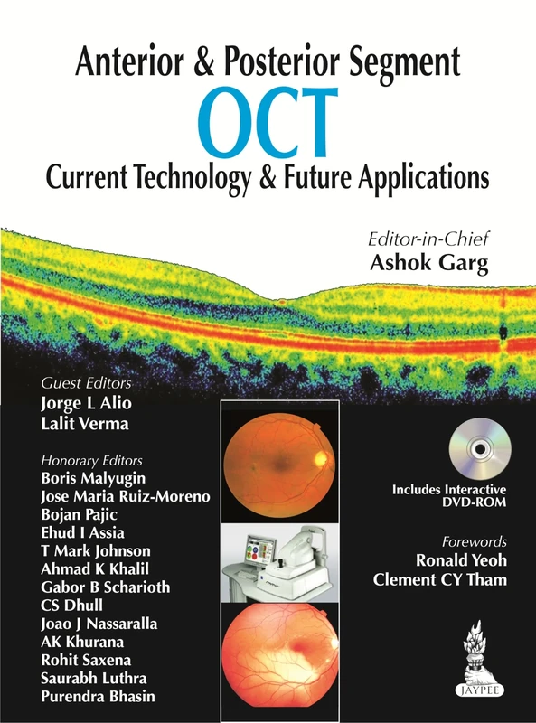 Anterior & Posterior Segment OCT: Current Technology & Future Applications