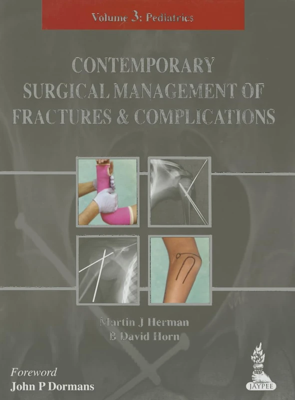 Contemporary Surgical Management of Fractures and Complications: Volume 3 - Pediatrics