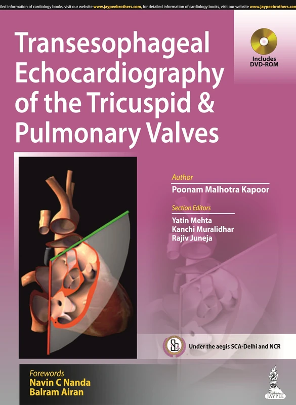 Jaypee Brothers TEE of Tricuspid and Pulmonary Valves Book