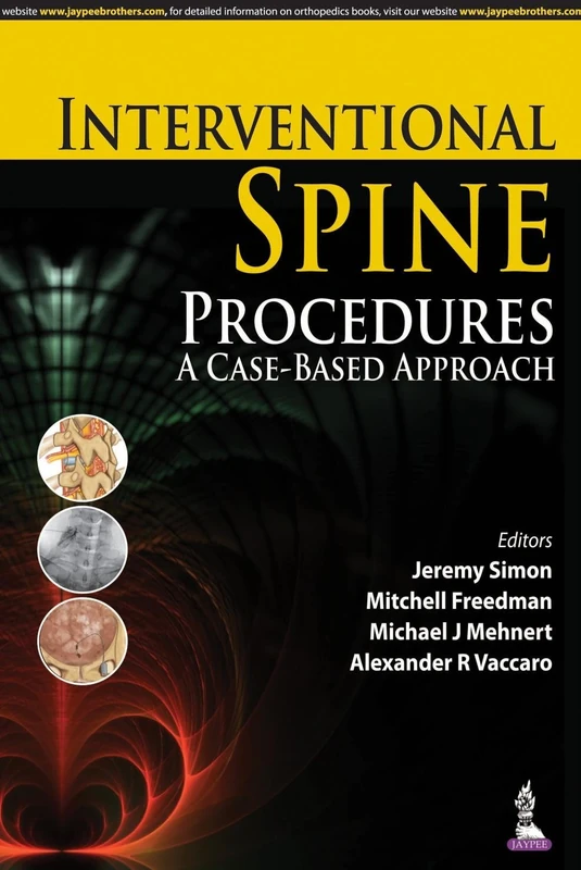 Interventional Spine Procedures: A Case-Based Approach