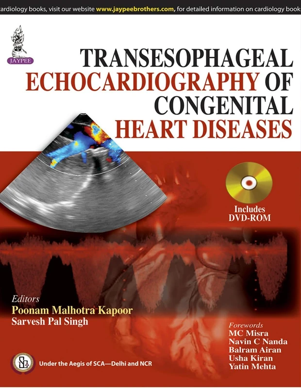 Transesophageal Echocardiography of Congenital Heart Diseases